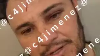 Instructor que recibió brutal golpiza de ‘Lord Pádel’, teme por su vida