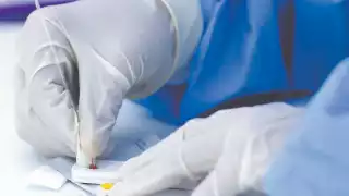 De acuerdo con datos del Boletín Epidemiológico Nacional, la  candidiasis urogenital es la afección más frecuente en la entidad