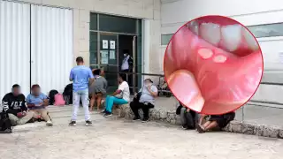 De enero a septiembre del año pasado se contabilizaron 324 diagnósticos, lo que significa que hubo 100 menos, lo que alertó a autoridades sanitarias