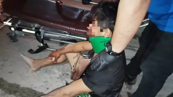 Joven sufre accidente en su motocicleta debido a un bache en Chetumal Joven sufre accidente en su motocicleta debido a un bache en Chetumal