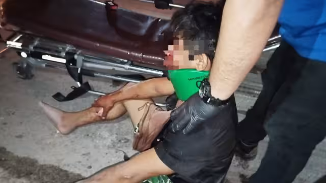 Joven sufre accidente en su motocicleta debido a un bache en Chetumal
