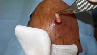 El especialista asegura que la plaga no está fuera de control, sin embargo, no está exenta de propagarse aún con todas las previsiones