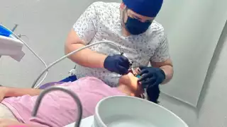 Reportan 18 mil casos de gingivitis; la mayoría, en hombres