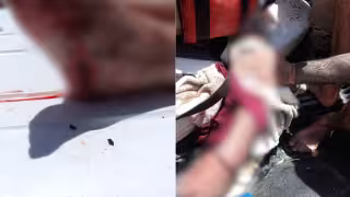 Paramédicos de Protección Civil, quienes brindaron los primeros auxilios al turista lesionado y posteriormente lo trasladaron a un hospital.