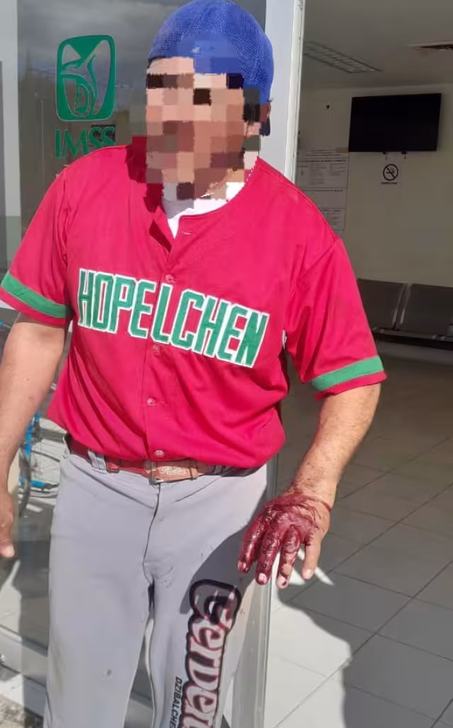 Uno de los beisbolistas terminó con una grave lesión en la mano.