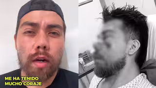 En los videos donde ha difundido su caso, compartió imágenes de las lesiones causadas por la agresión