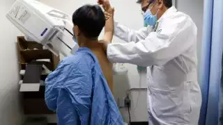 Mujeres y hombres han sido detectados con cáncer de mama en Yucatán durante 2025