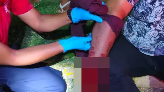 El lesionado fue rápidamente atendido por paramédicos El lesionado fue rápidamente atendido por paramédicos