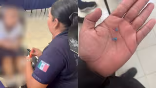 El niño se tragó las chaquiras de una pulsera que llevaba puesto