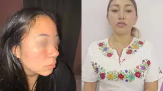 Destituyen a directora de Deportes en Candelaria por agresión a universitaria