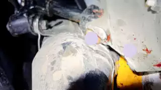 Menor de edad pierde dos dedos tras accidentes vehicular en Chetumal