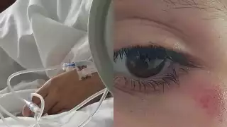 La menor fue canalizada debido a la gravedad de las lesiones