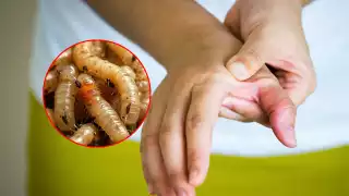 El gusano barrenador se encuentra comúnmente en las heridas de los animales.