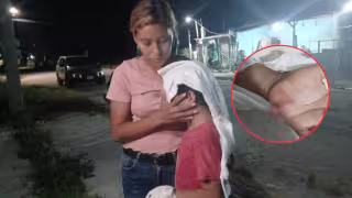 Ataque de perro a menor genera preocupación en colonia Fátima