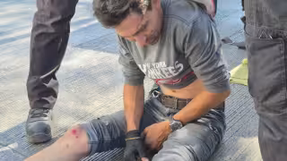 Motociclista resulta lesionado tras ser arrollado por camioneta en la Periférica Norte.