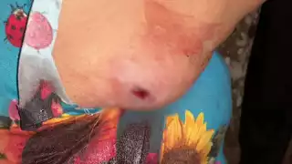 La mujer terminó con herida de bala en el brazo