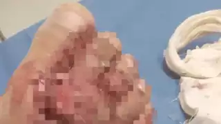 Menor de dos años es afectado por problemas familiares; mientras sus padres pelean por dinero, él se encuentra en espera de una cirugía