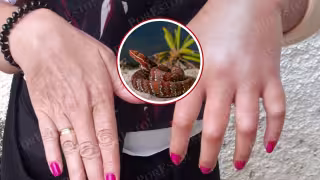 Antivenenos de Birmex y Silanes salvan vidas en Campeche