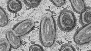 ¿Cómo identificar los síntomas del mpox en México?