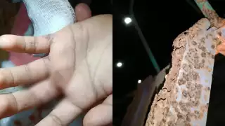 Vecinos de la zona señalan que el deterioro del parque es una situación que se ha prolongado durante años