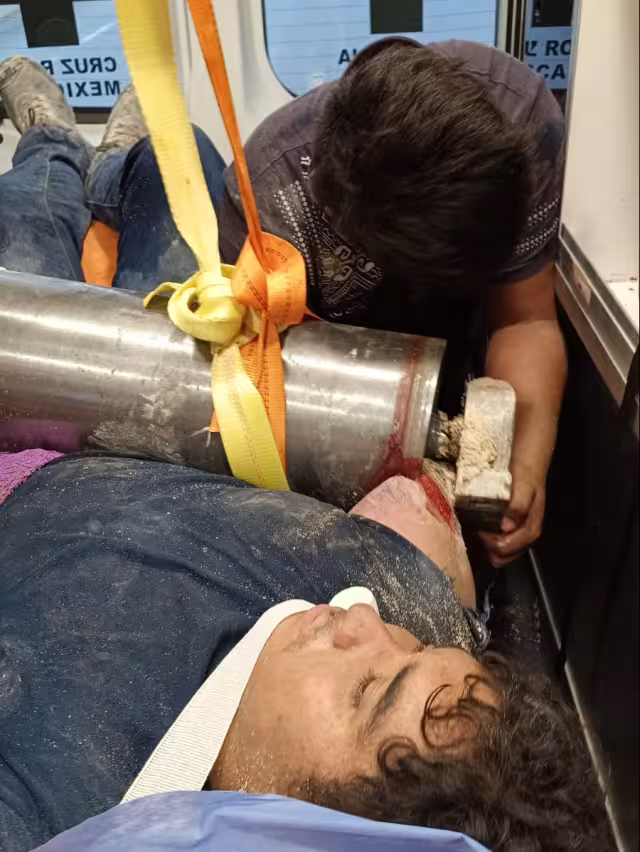 Trabajador del Tren Maya accidenta su brazo dentro de una trituradora de piedras.