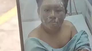 Menor quemado por un petardo en Xul-Ha será trasladado a CDMX