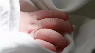  Desde su ingreso al nosocomio, el estado de salud de la infante es grave