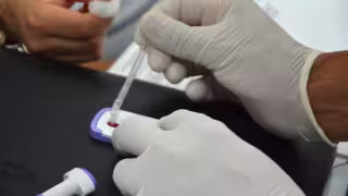 Avanza la detección temprana del VIH en Yucatán: 32 de 45 casos detectados en mes y medio del 2026 están en fase inicial