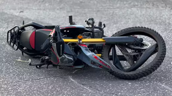 El motociclista sufrió lesiones y parecía tener el hombro dislocado. El motociclista sufrió lesiones y parecía tener el hombro dislocado.