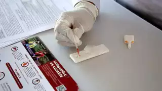 Solo una minoría de los infectados conoce su diagnóstico, lo que dificulta el control y la propagación del virus en la población