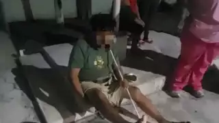 Felipe Aké Canché presenta un diagnóstico de pie diabético avanzado.