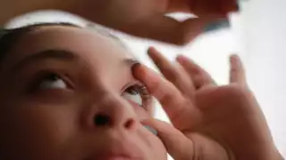 Conjuntivitis se dispara en la Península de Yucatán: más de 12 mil casos

