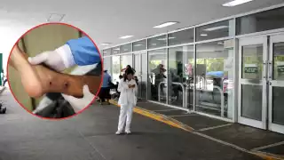 El padecimiento es provocado por un insecto pequeño, el cual transmite un parásito y genera heridas abiertas en la piel que tardan en sanar