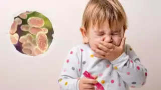  La infección afecta a personas de cualquier edad, pero en los bebés puede provocar discapacidad permanente y la muerte