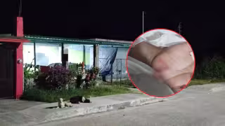 Campeche registra 9 casos confirmados de sarampión en 2026.