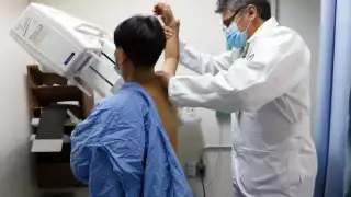 Casos de cáncer de mama en Quintana Roo aumentan un 28%