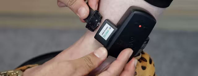 El hombre tendrá que usar el brazalete electrónico mientras dure la investigación y el proceso en su contra