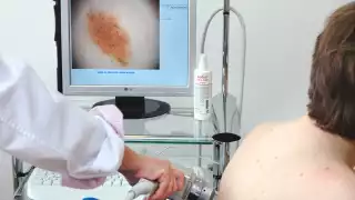 De acuerdo con organizaciones civiles, las cifras oficiales podrían ser mayores, debido a que muchas personas no acuden al doctor