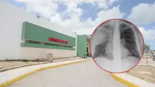 La lluvia, humedad y uso excesivo del aire acondicionado favorecen afecciones, según experto