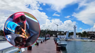 El hombre de 65 años de edad habría sufrido la amputación de su pierna