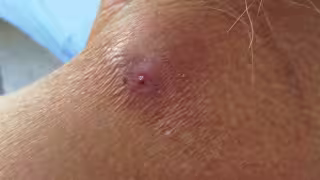 Ancianito de 80 años logra vencer al gusano barrenador; Hopelchén en alerta por plaga y sequías