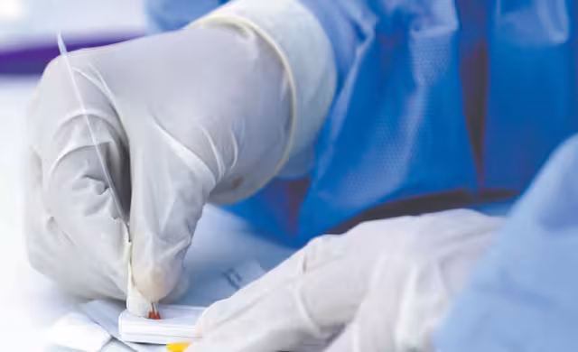 De acuerdo con datos del Boletín Epidemiológico Nacional, la  candidiasis urogenital es la afección más frecuente en la entidad