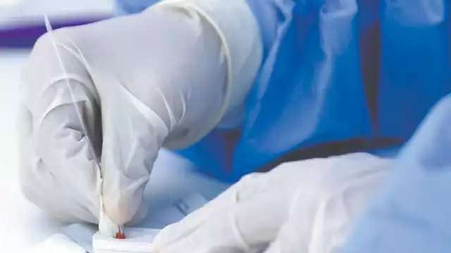 De acuerdo con datos del Boletín Epidemiológico Nacional, la  candidiasis urogenital es la afección más frecuente en la entidad