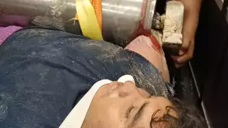 Trabajador del Tren Maya accidenta su brazo dentro de una trituradora de piedras.