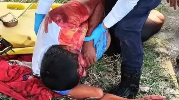 El hombre fue atendido por paramédicos y después trasladado a un hospital.