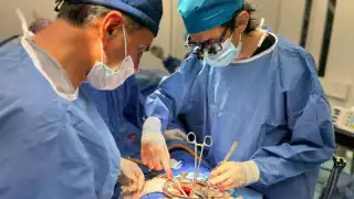 Yucatán destaca a nivel nacional por altos índices de éxito en trasplantes pediátricos