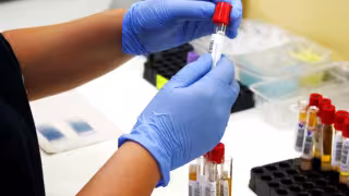 Alerta epidemiológica: hepatitis A y B presentes en la entidad