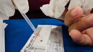 Campeche registra ocho nuevos casos de VIH; SSA alerta sobre prácticas de riesgo