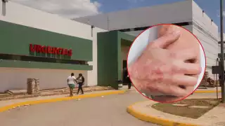 El ácaro Sarcoptes scabiei se introduce en la capa superior de la piel, donde deposita huevos, genera lesiones y picazón