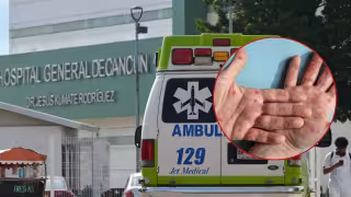 De acuerdo con reportes, todos los pacientes con lesiones en la piel son hombres; con mayor incidencia en la zona norte